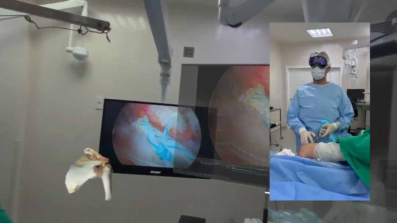 VisionPro Shoulder Arthroscopy